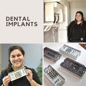 dental implants ad